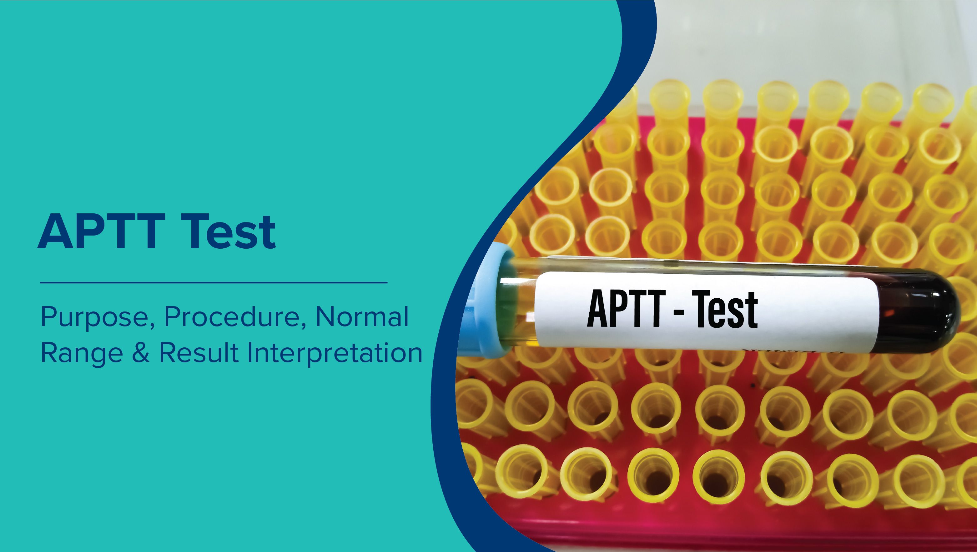 APTT Test: Purpose, Procedure, Normal Range & Result Interpretation