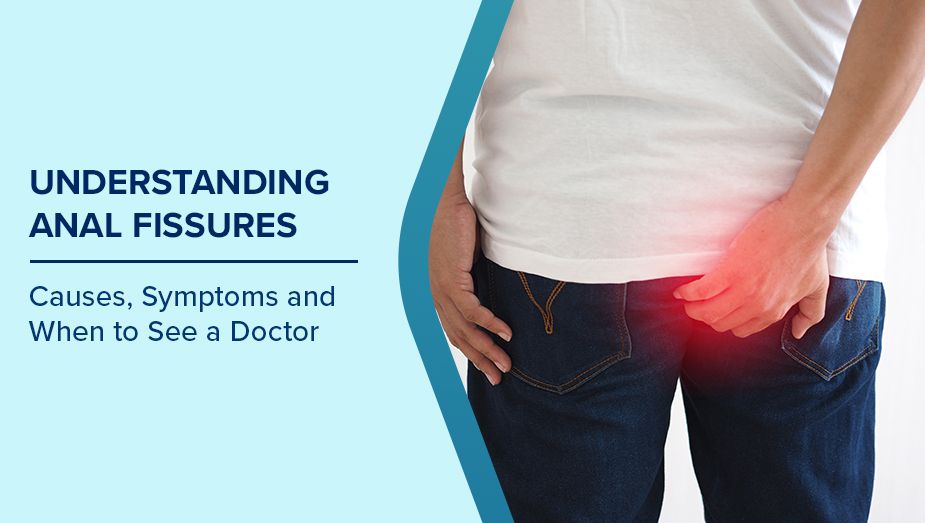 Anal Fissure Symptoms