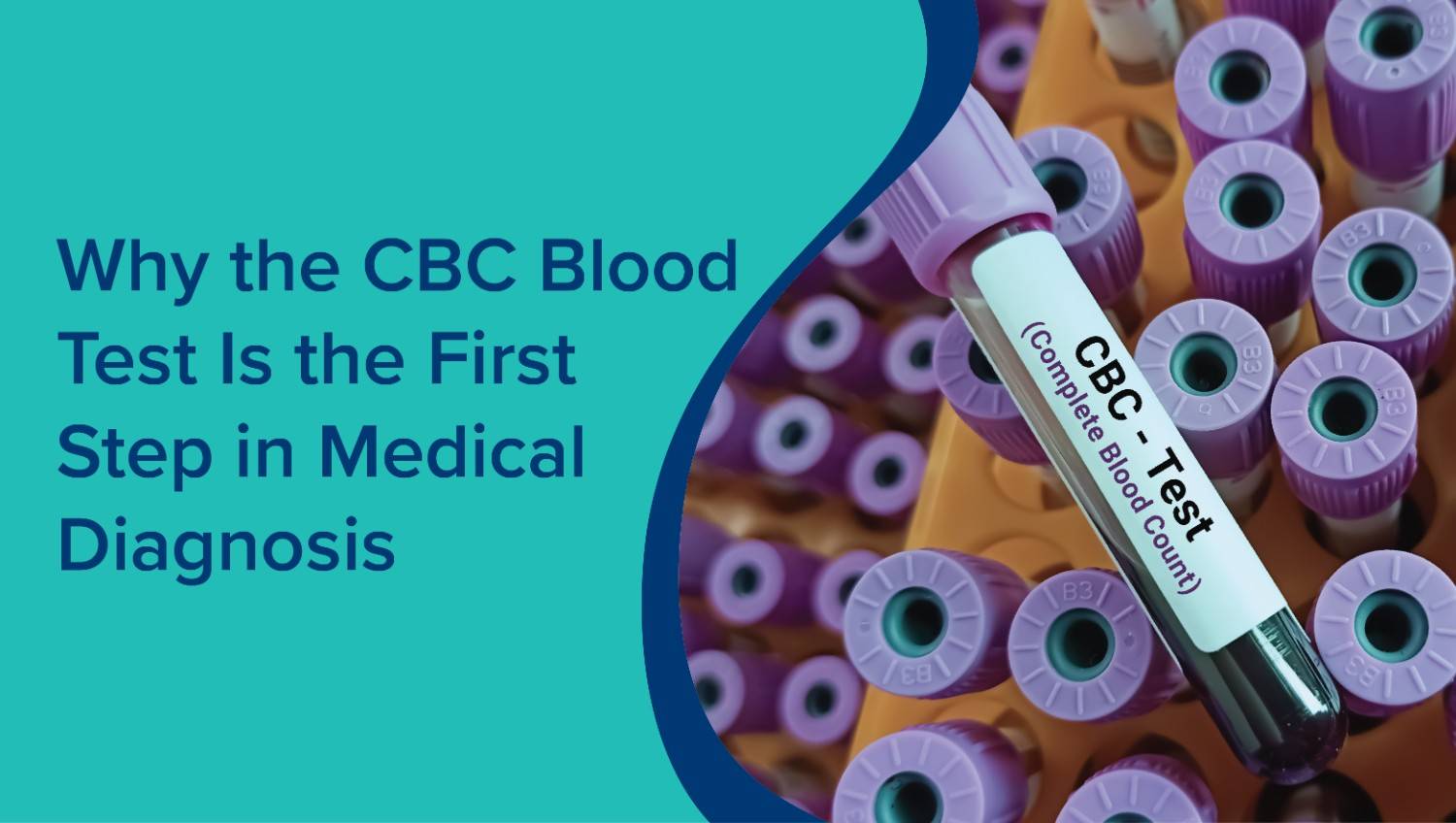 Why the CBC Blood Test Is the First Step in Medical Diagnosis