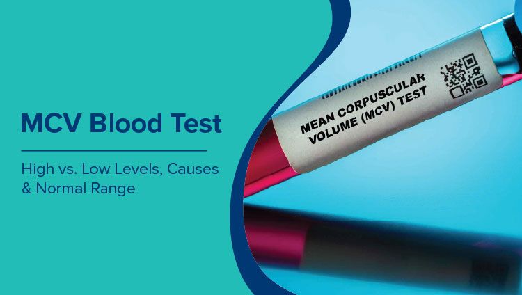 MCV Blood Test: High vs. Low Levels, Causes, & Normal Range