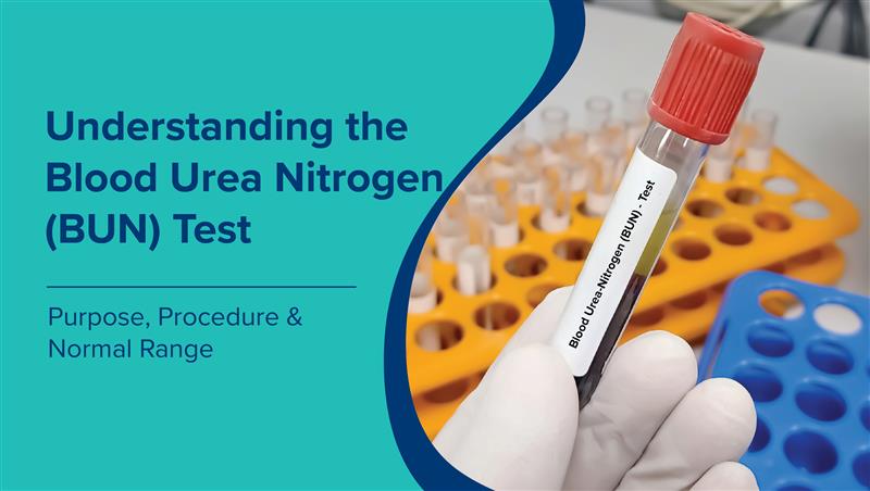 Understanding the Blood Urea Nitrogen (BUN) Test: Purpose, Procedure, and Normal Range