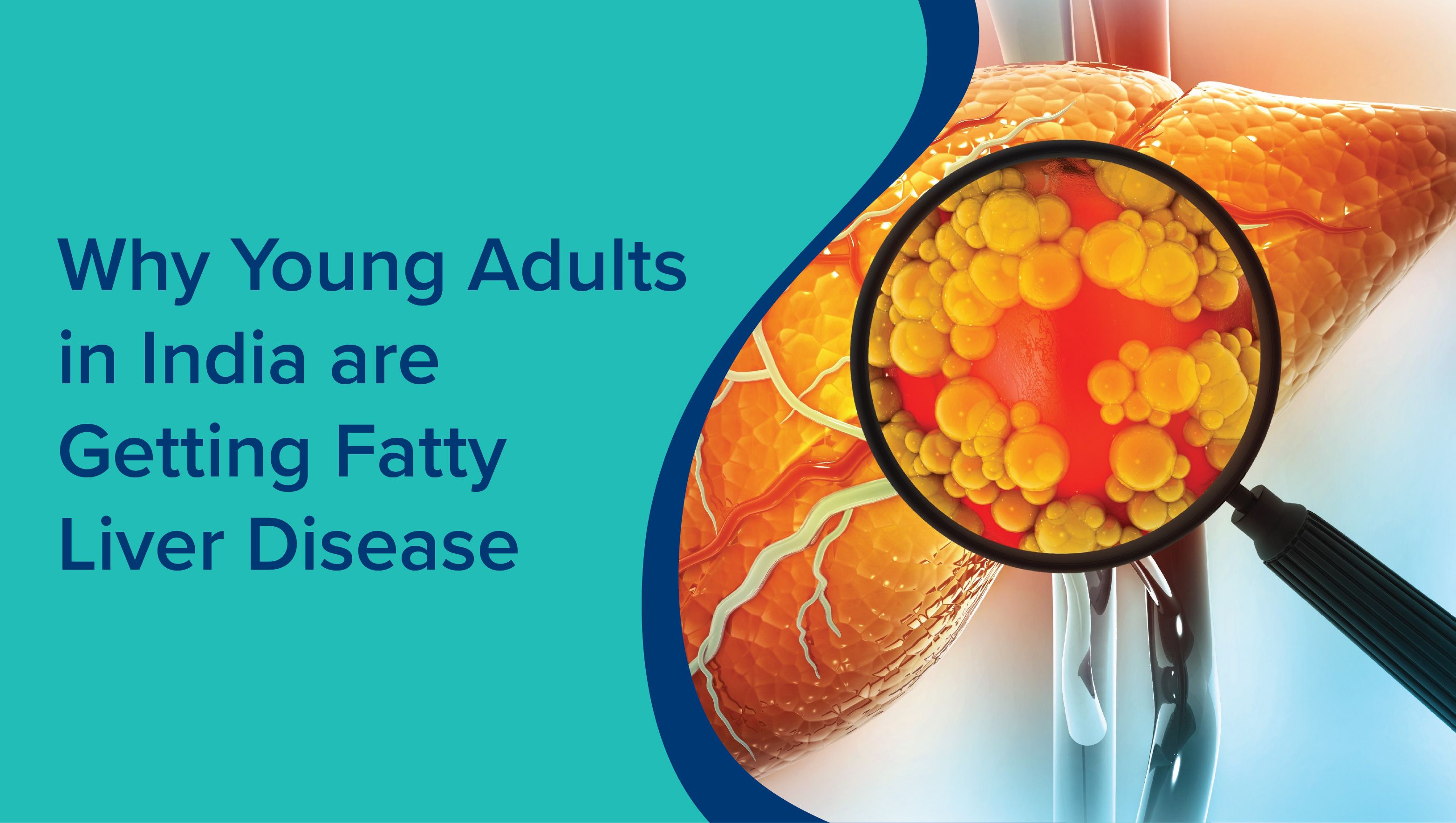 Why Young Adults in India Are Getting Fatty Liver Disease