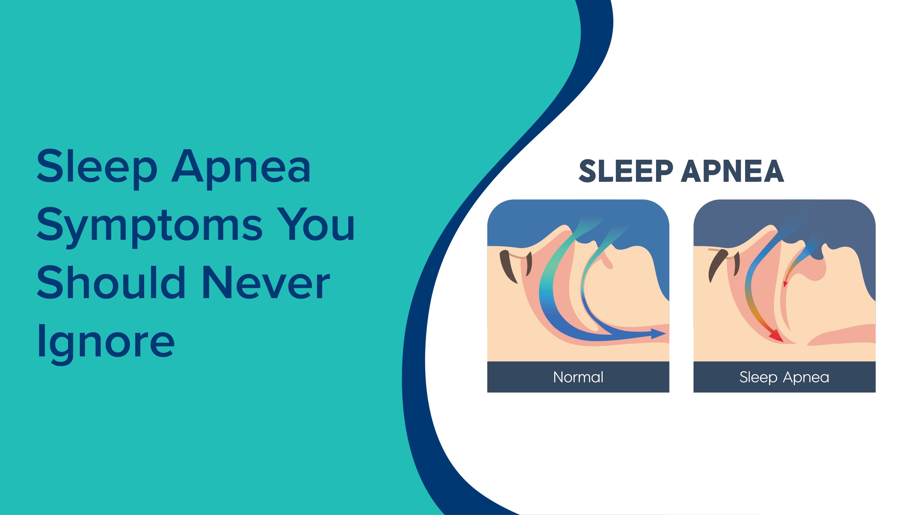 Sleep Apnea Symptoms You Should Never Ignore