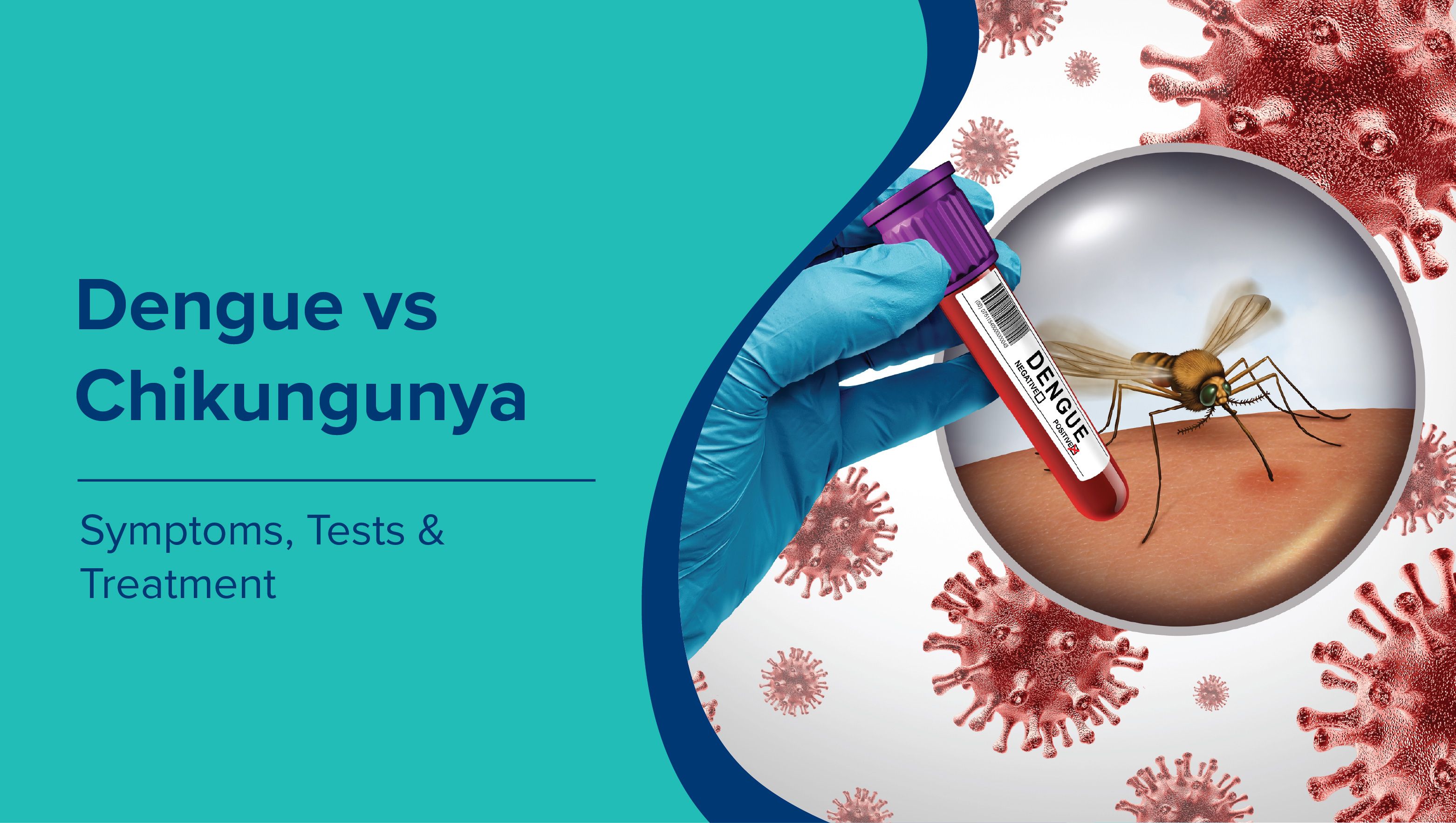 Dengue vs Chikungunya: Symptoms, Tests & Treatment Guide