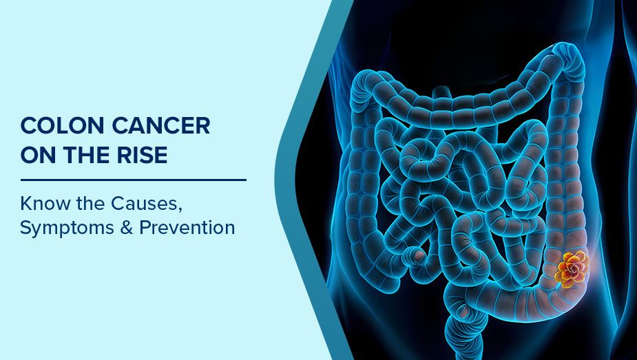 Colon Cancer Symptoms
