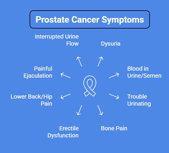 Common Symptoms of Prostate Cancer