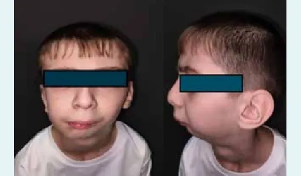 missing image