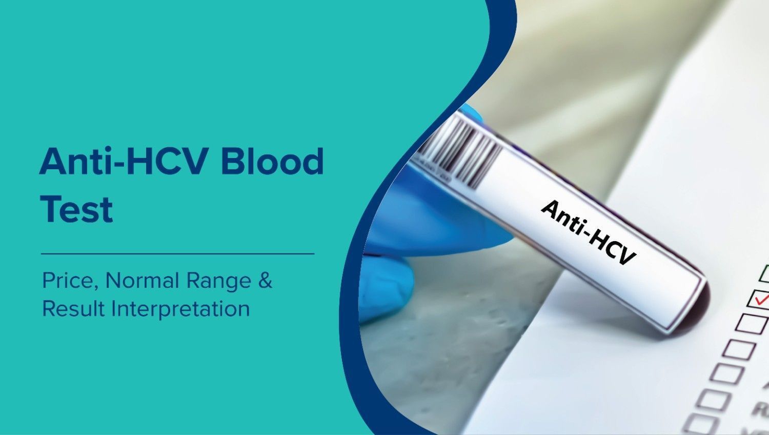 एंटी-एचसीवी रक्त परीक्षण  (Anti HCV Blood Test in Hindi) – कीमत, सामान्य सीमा और परिणाम की व्याख्या