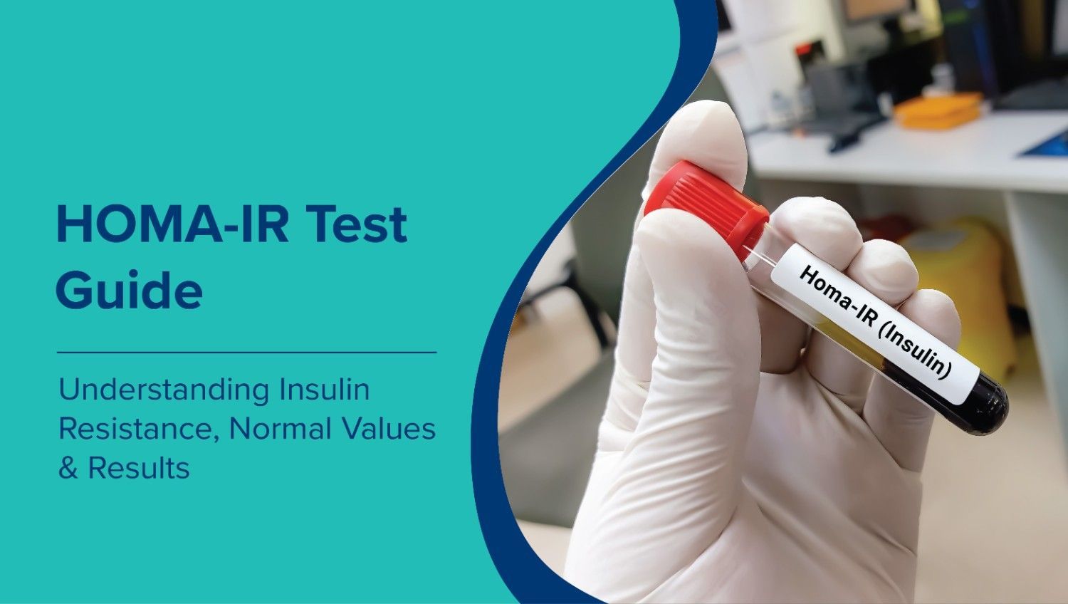  HOMA-IR Test Guide: Understanding Insulin Resistance, Normal Values & Results