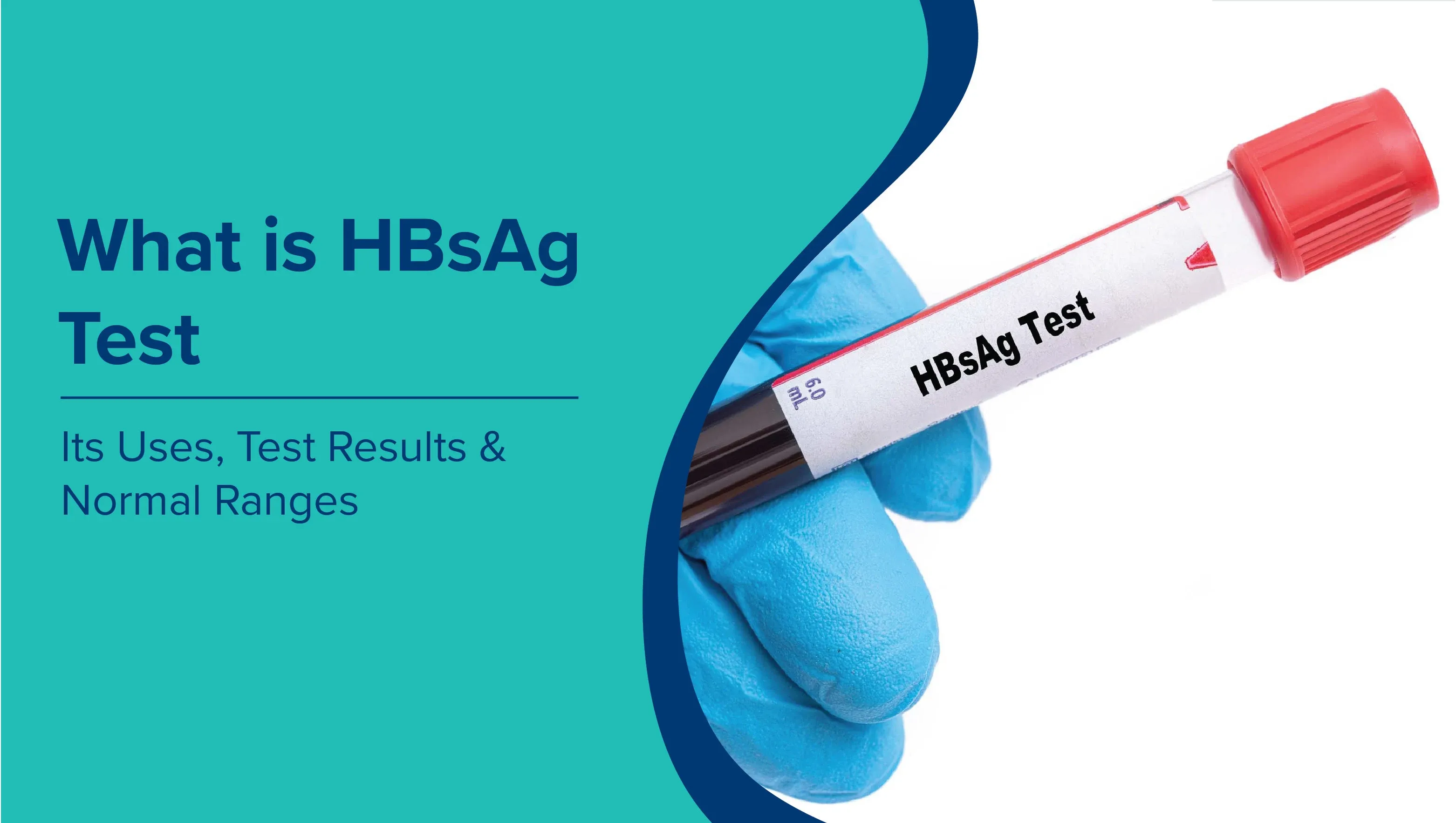What is HBsAg Test: Uses, Test Results & Normal Ranges
