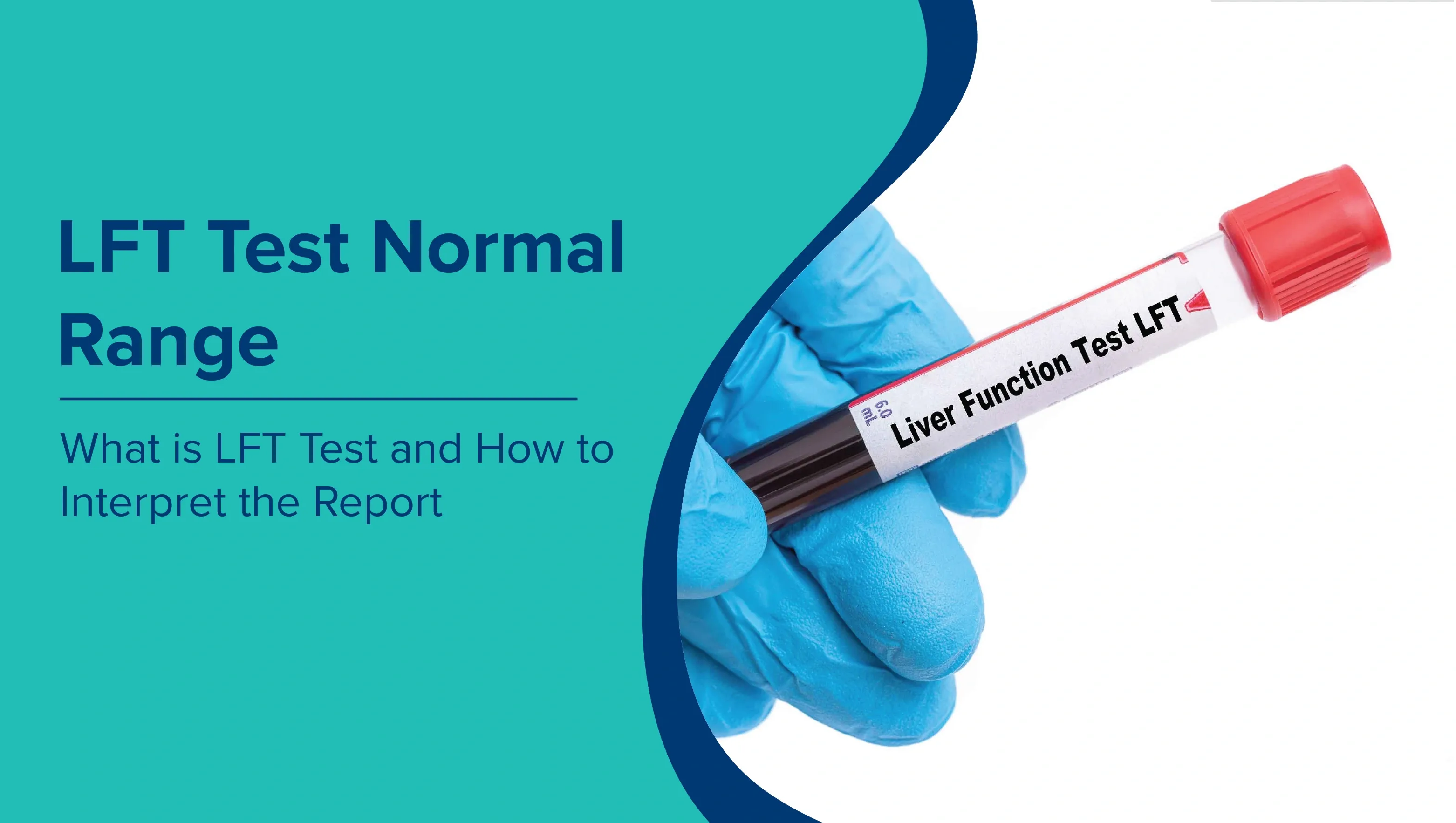 LFT Test Normal Range: What is LFT Test and How to Interpret the Report