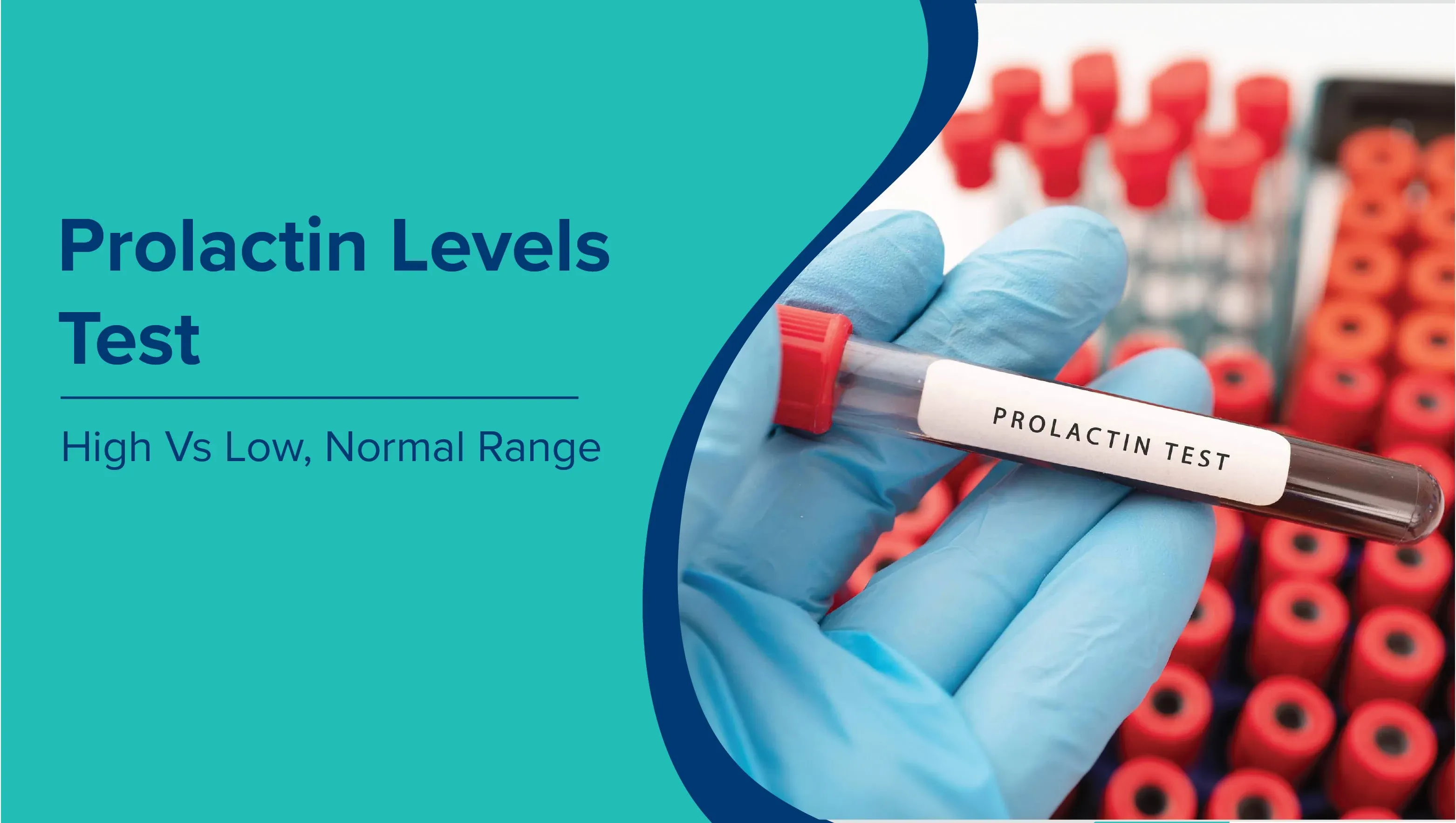 Understanding Prolactin: High, Low & Normal Levels Explained