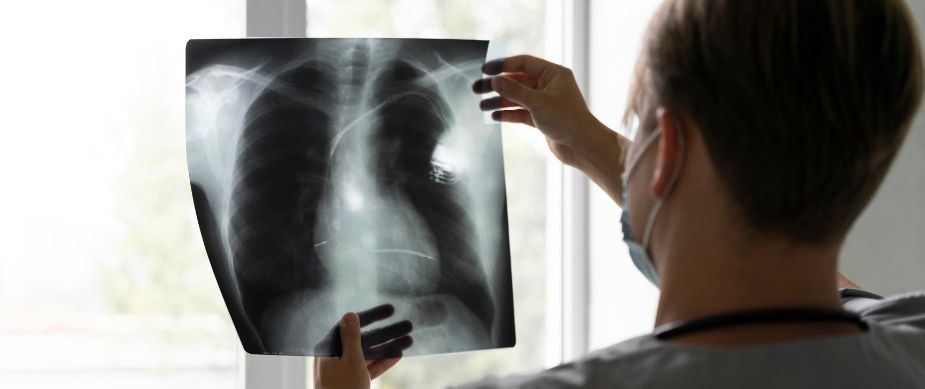 elfbar nachfüll pod läuft aus Ventilator-associated events criteria in the assessment of  Ventilator-Associated Pneumonia (IMPACTO MR-PAV): A prospective cohort main image 0