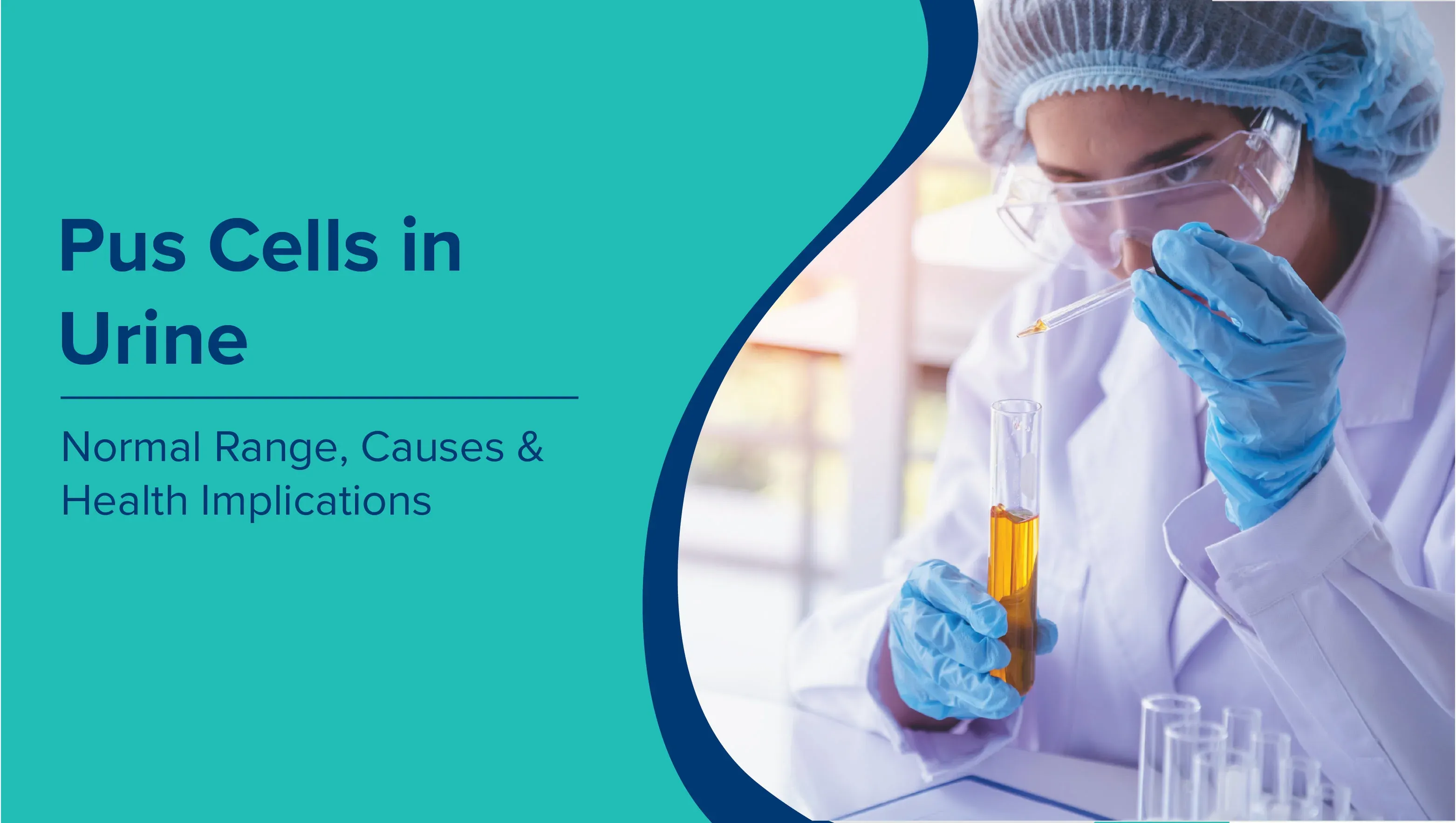 Pus Cells in Urine: Normal Range, Causes, and Health Implications