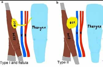Robotic_Surgery_fig_1