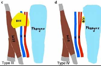 Robotic_Surgery_fig_1b
