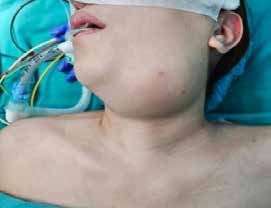 Robotic_Surgery_fig_2
