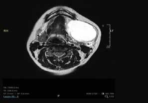 Robotic_Surgery_fig_3a