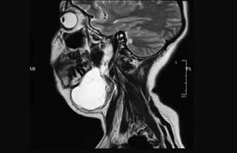 Robotic_Surgery_fig_3b
