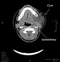 Robotic_Surgery_fig_4