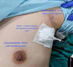Robotic_Surgery_fig_5