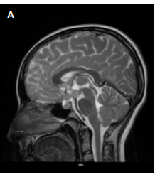missing image