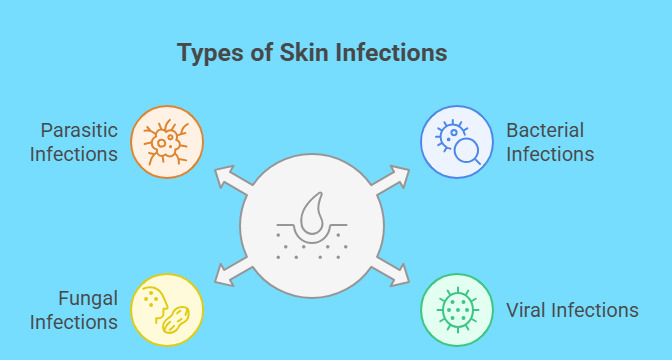Types of Skin Infections
