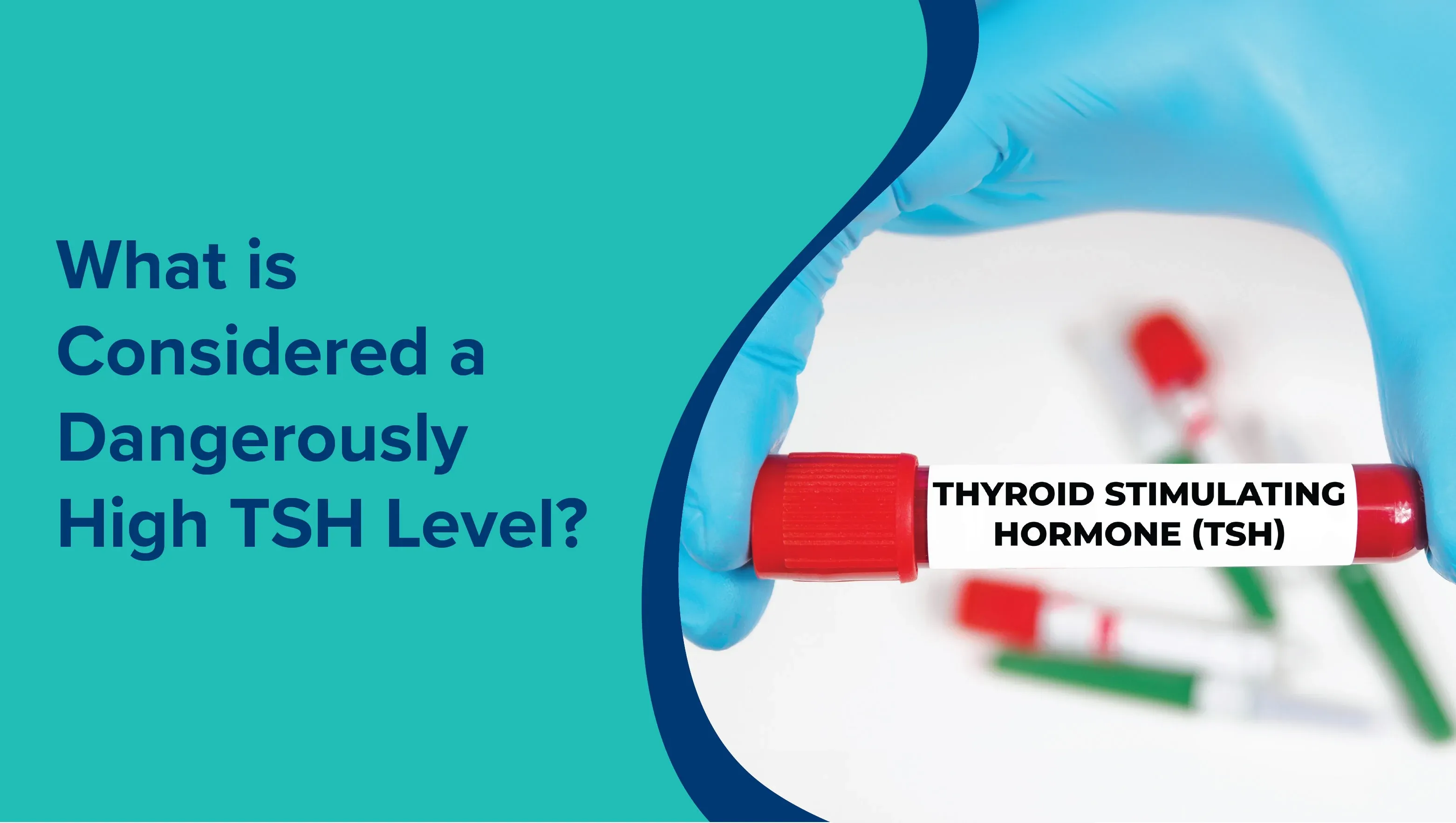 What Is Considered a Dangerously High TSH Level? 