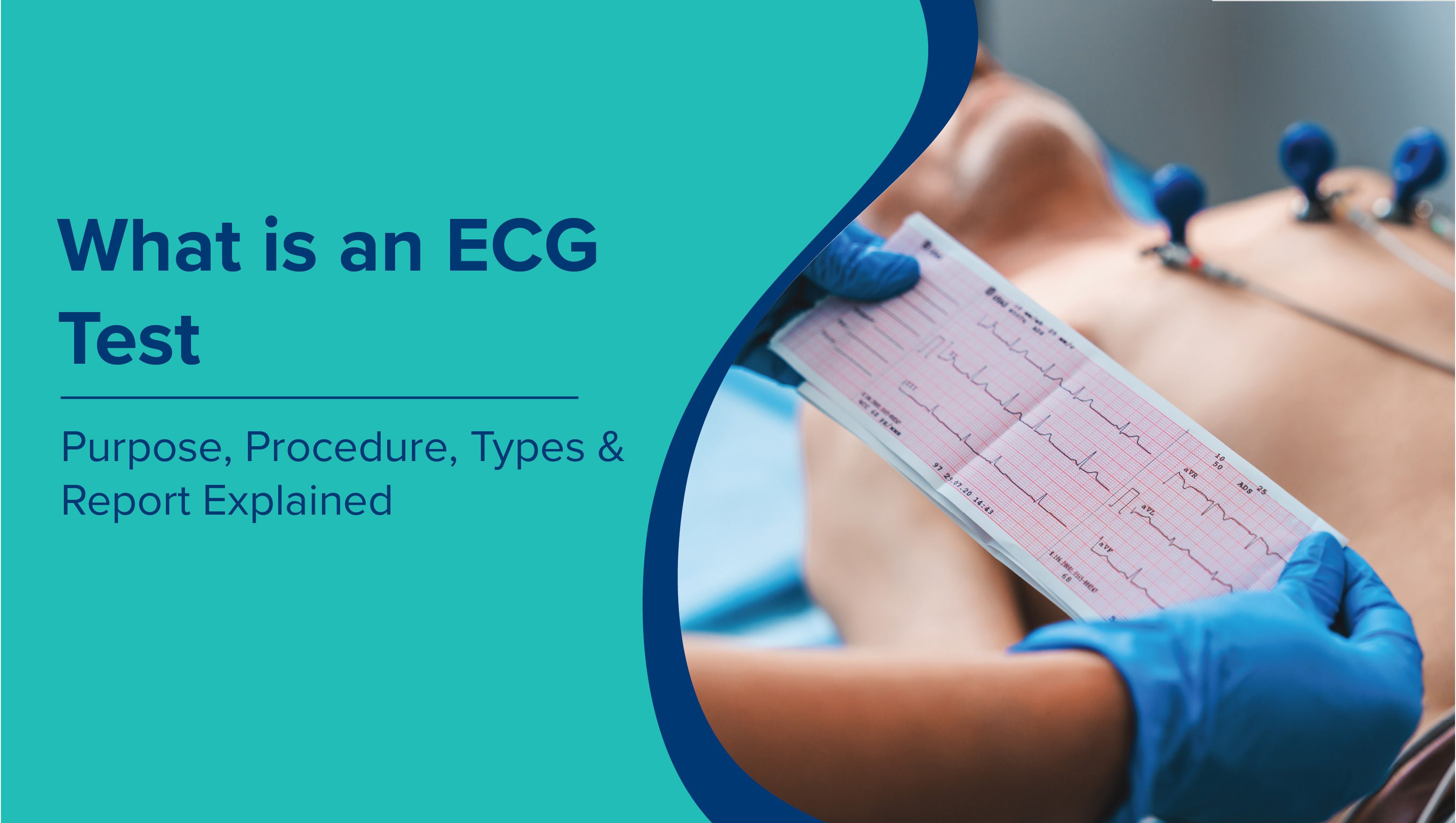What is an ECG Test? Purpose, Procedure, Types & Report Explained