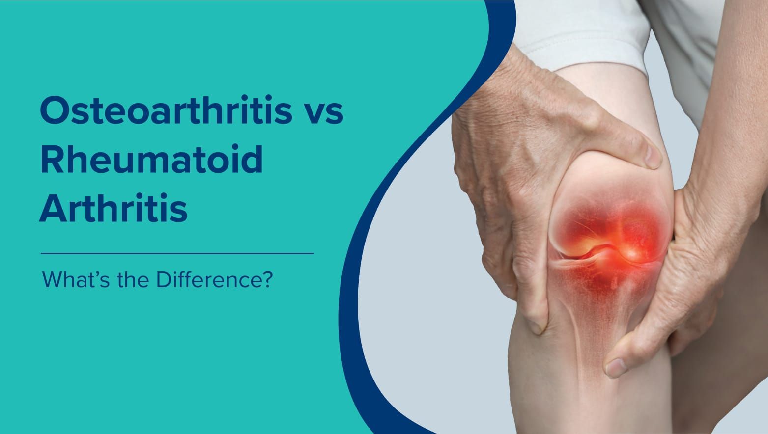 Osteoarthritis vs Rheumatoid Arthritis: What's the Difference