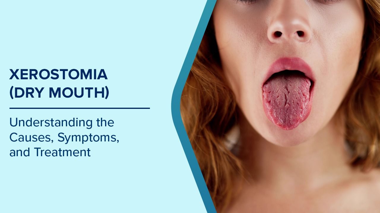 does chewing tobacco cause dry mouth What can dipping and do to your body? 5 things you need to know You might think it's safer because there's no smoke but smokeless tobacco is still extremely dangerous Smokeless Tobacco: Meaning, Side Effects,