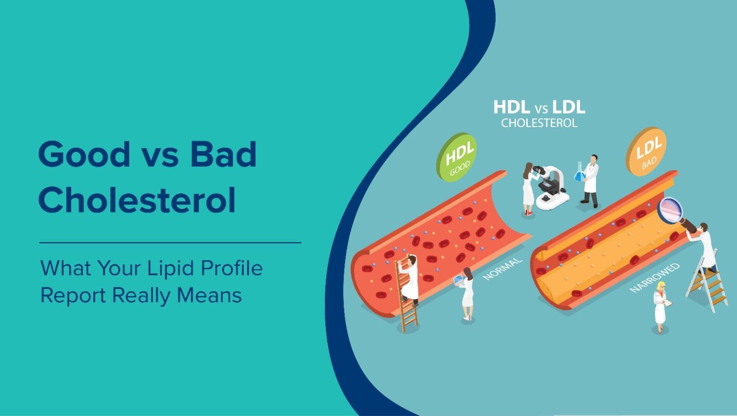 Good vs Bad Cholesterol: What Your Lipid Profile Report Really Means