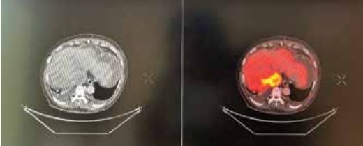 missing image