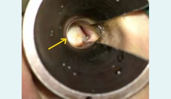  Otomicroscopic Examination