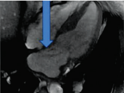 Figure 2(A)