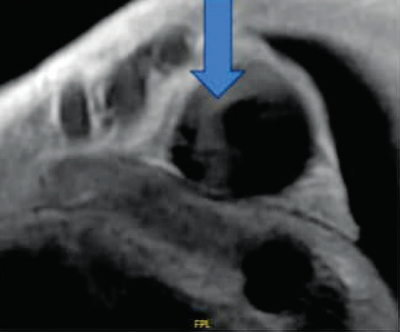 Figure 2(B)