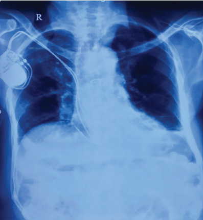 figure2
