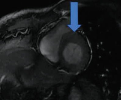 Figure 2(C)