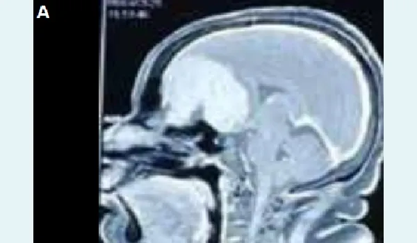 missing image