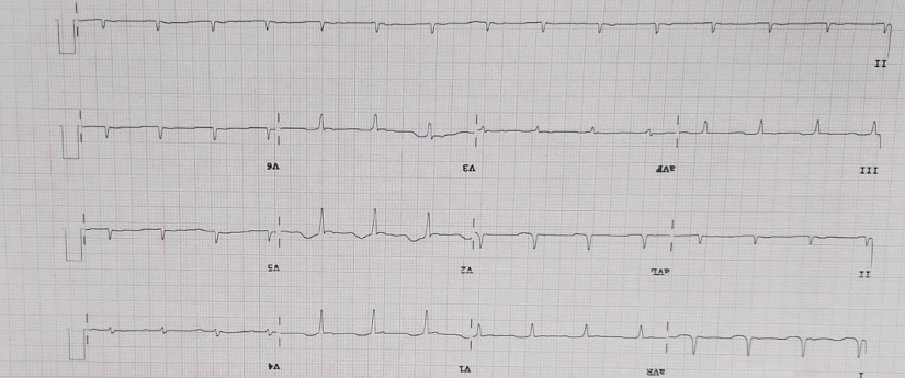 figure5