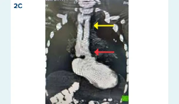 missing image