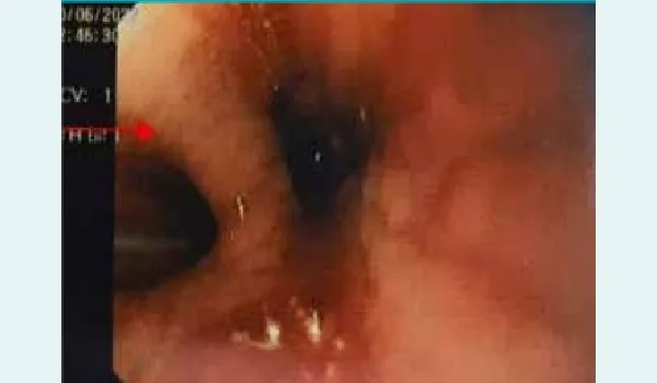 missing image