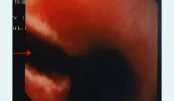 missing image