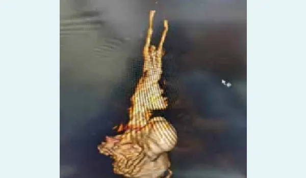 missing image