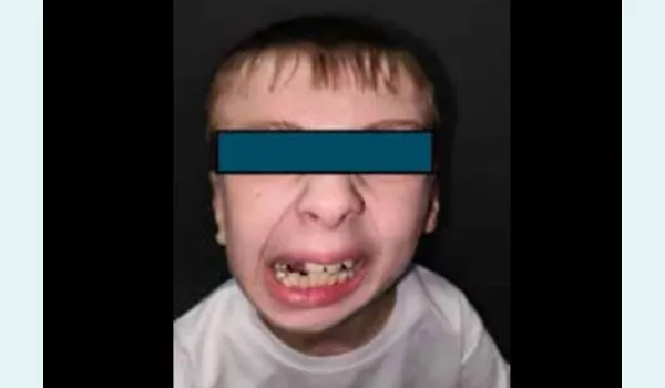 missing image