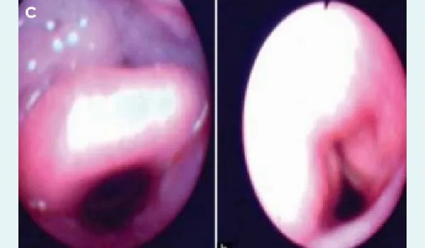 missing image