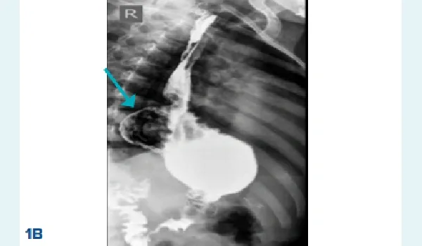 missing image