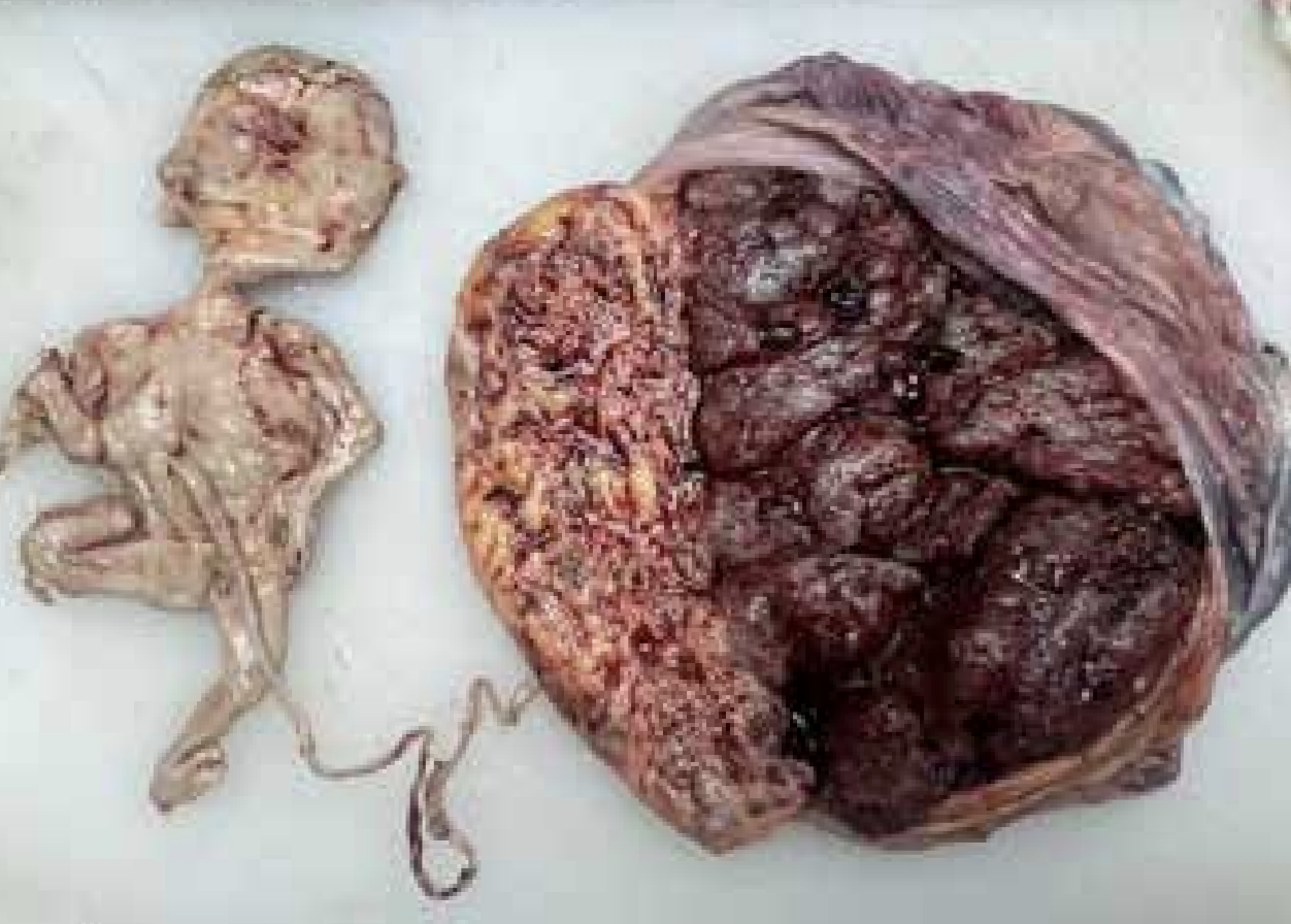 missing image