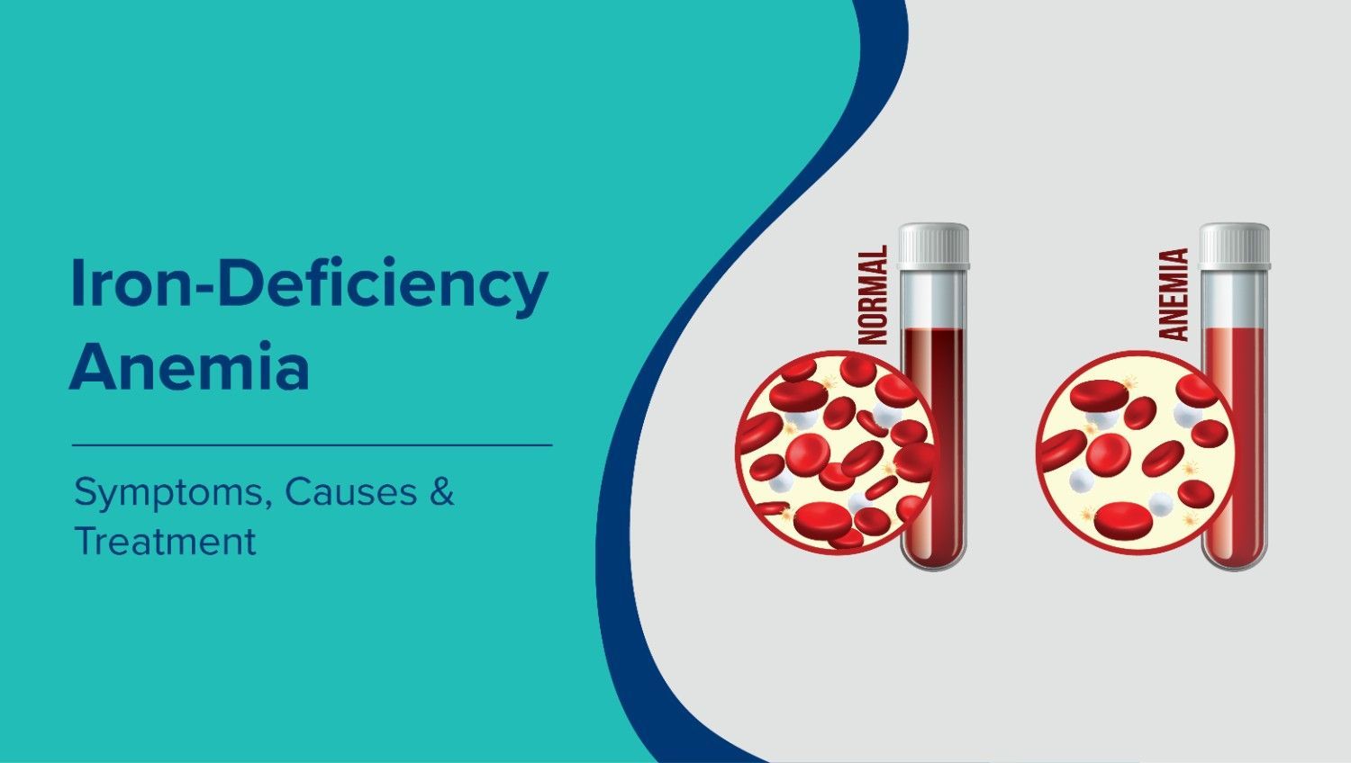  Iron-Deficiency Anaemia: Symptoms, Causes & Treatment