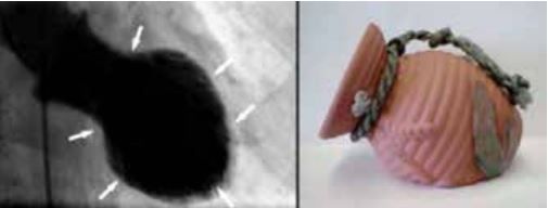 missing image